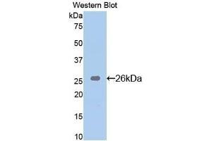 Detection of Recombinant Bid, Mouse using Polyclonal Antibody to BH3 Interacting Domain Death Agonist (Bid) (BID anticorps  (AA 1-195))