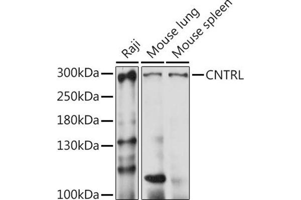 Centriolin Antikörper  (AA 250-500)