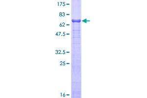 Image no. 1 for alpha-2-HS-Glycoprotein (AHSG) (AA 19-367) protein (GST tag) (ABIN1344652)