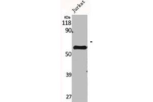 Western Blot analysis of Jurkat cells using CYP2A7 Polyclonal Antibody