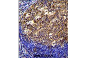 PTK9L Antibody immunohistochemistry analysis in formalin fixed and paraffin embedded human tonsil tissue followed by peroxidase conjugation of the secondary antibody and DAB staining. (TWF2 anticorps  (N-Term))