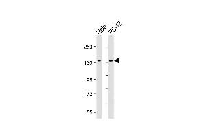 All lanes : Anti-KIF1B Antibody at 1:2000 dilution Lane 1: Hela whole cell lysate Lane 2: PC-12 whole cell lysate Lysates/proteins at 20 μg per lane.