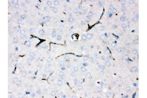 Ceruloplasmin was detected in paraffin-embedded sections of mouse brain tissues using rabbit anti- Ceruloplasmin Antigen Affinity purified polyclonal antibody at 1 μg/mL.