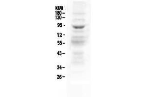 Western blot analysis of MAP3K20 using anti-MAP3K20 antibody . (ZAK anticorps  (AA 276-511))