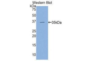 Western Blotting (WB) image for anti-Hexokinase 2 (HK2) (AA 619-917) antibody (ABIN1859176) (Hexokinase 2 anticorps  (AA 619-917))