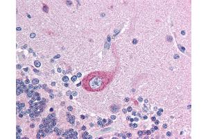 Anti-BRD4 antibody IHC of human brain, cerebellum.