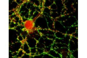 anti-Synaptopodin (SYNPO) (AA 331-452), (Isoform 2) antibody
