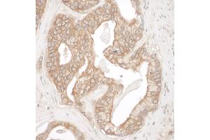 Immunohistochemistry (IHC) image for anti-Cortactin (CTTN) (AA 450-500) antibody (ABIN7454844)