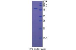 SDS-PAGE analysis of Rat LEFTY1 Protein. (LEFTY1 Protéine)