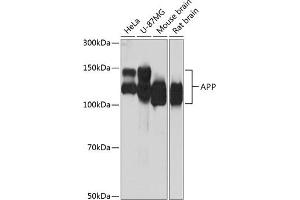Western blot analysis of extracts of various cell lines, using APP antibody (ABIN7265575) at 1:1000 dilution. (APP anticorps)