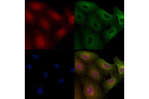 ABIN6260199 and ABIN6266752 staining  cells by IF/ICC.