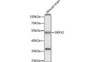 Western blot analysis of extracts of mouse brain, using SRPX2 antibody (ABIN7270653) at 1:1000 dilution.