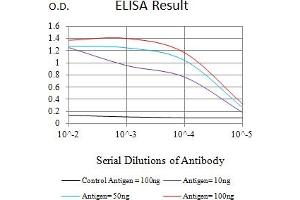 Black line: Control Antigen (100 ng),Purple line: Antigen (10 ng), Blue line: Antigen (50 ng), Red line:Antigen (100 ng) (ACTH anticorps)