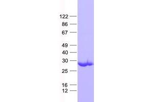 Validation with Western Blot