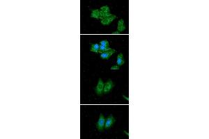 anti-Acyl-CoA Dehydrogenase, C-2 To C-3 Short Chain (Acads) (AA 25-412) antibody