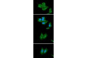 ICC/IF analysis of ACADS in Hep3B cells line, stained with DAPI (Blue) for nucleus staining and monoclonal anti-human ACADS antibody (1:100) with goat anti-mouse IgG-Alexa fluor 488 conjugate (Green).
