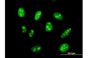 Immunofluorescence of purified MaxPab antibody to DIMT1L on HeLa cell. (DIMT1 anticorps  (AA 1-313))