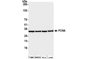 Western Blotting (WB) image for anti-Proliferating Cell Nuclear Antigen (PCNA) antibody (ABIN7453982)