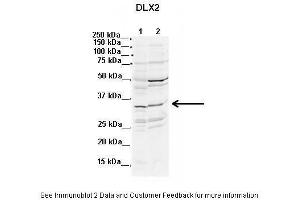 Lanes:  1. (DLX2 anticorps  (N-Term))