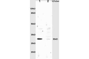 L1 rat liver lysates L2 rat brain lysates probed with Anti NQO1 Polyclonal Antibody, Unconjugated (ABIN678428) at 1:200 overnight at 4 °C. (NQO1 anticorps  (AA 201-274))