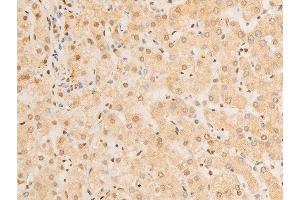 ABIN6267237 at 1/100 staining human liver tissue sections by IHC-P.