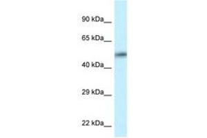Image no. 1 for anti-Calcium/calmodulin-Dependent Protein Kinase II delta (CAMK2D) (AA 302-351) antibody (ABIN6747600) (CAMK2D anticorps  (AA 302-351))