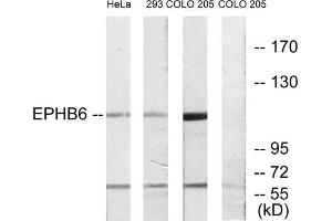Western blot analysis of extracts from HeLa cells, 293 cells and COLO cells, using EPHB6 antibody. (EPH Receptor B6 anticorps  (C-Term))