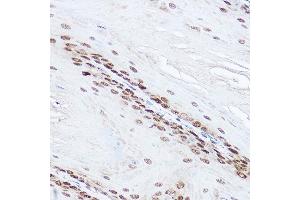 Immunohistochemistry of paraffin-embedded mouse stomach using SOD1 Rabbit pAb (ABIN3020854, ABIN3020855, ABIN3020856 and ABIN6213758) at dilution of 1:150 (40x lens). (SOD1 anticorps  (AA 1-154))