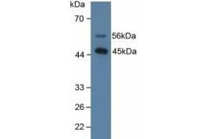 Detection of SPD in Human Lung Tissue using Polyclonal Antibody to Surfactant Associated Protein D (SPD) (SFTPD anticorps  (AA 21-375))
