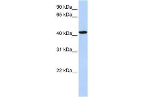 WB Suggested Anti-TADA1L Antibody Titration: 0. (TADA1 anticorps  (C-Term))