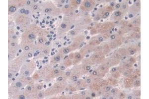 DAB staining on IHC-P; Samples: Human Liver Tissue (CRABP2 anticorps  (AA 1-138))