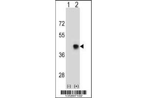 Western blot analysis of SPEM1 using rabbit polyclonal SPEM1 Antibody using 293 cell lysates (2 ug/lane) either nontransfected (Lane 1) or transiently transfected (Lane 2) with the SPEM1 gene.