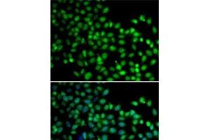 Immunofluorescence analysis of A-549 cells using FKBP6 Polyclonal Antibody (FKBP6 anticorps)