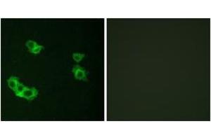 Immunofluorescence analysis of MCF7 cells, using PTHR1 Antibody. (PTH1R anticorps  (AA 145-194))