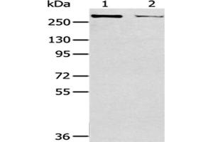 Gel: 6 % SDS-PAGE,Lysate: 40 μg,Lane 1-2: MCF7 cells, Hela cells,Primary antibody: ABIN7193051(WNK2 Antibody) at dilution 1/200 dilution,Secondary antibody: Goat anti rabbit IgG at 1/8000 dilution,Exposure time: 10 minutes (WNK2 anticorps)