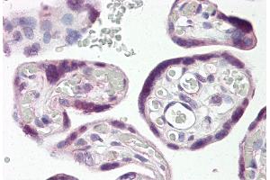 Placenta (DLX3 anticorps  (N-Term))