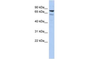 Western Blotting (WB) image for anti-Chromosome 1 Open Reading Frame 103 (C1orf103) antibody (ABIN2463957) (C1orf103 anticorps)
