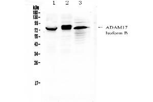 Western blot analysis of ADAM17 using anti-ADAM17 antibody . (ADAM17 anticorps  (AA 215-433))