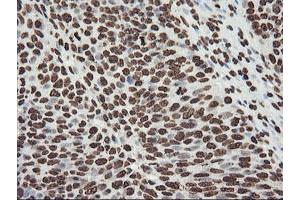 Image no. 10 for anti-F-Box Protein 21 (FBXO21) antibody (ABIN1498233) (FBXO21 anticorps)