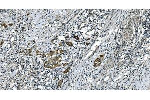 IHC analysis of CDC123 using anti-CDC123 antibody (ABIN7599284). (CDC123 anticorps  (AA 1-336))
