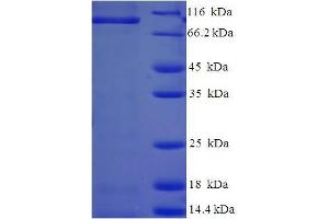 Caprin-1 (AA 2-707) protein (His tag) expressed in E.