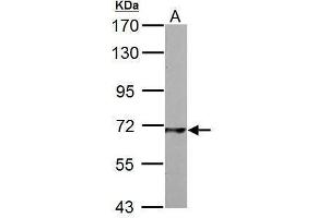 WB Image PCK2 antibody [C1C2], Internal detects PCK2 protein by Western blot analysis.