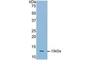 Detection of Recombinant ICOS, Mouse using Polyclonal Antibody to Inducible T-Cell Co Stimulator (ICOS) (ICOS anticorps  (AA 35-131))