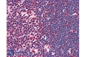 anti-Interleukin Enhancer Binding Factor 2, 45kDa (ILF2) (Internal Region) antibody