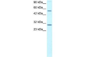 WB Suggested Anti-OSR2 Antibody Titration: 0. (OSR2 anticorps  (N-Term))