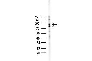 anti-MAP/microtubule Affinity-Regulating Kinase 3 (MARK3) (N-Term) antibody