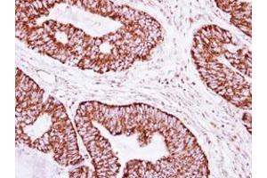 Image no. 1 for anti-ClpP Caseinolytic Peptidase, ATP-Dependent, Proteolytic Subunit Homolog (E. Coli) (CLPP) (AA 48-272) antibody (ABIN1497534)