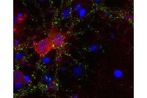 Indirect immunostaining of PFA fixed rat hippocampus neurons with anti-GAT 3 (dilution 1 : 500; red) and mouse anti-synapsin 1 (cat.