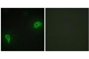 Immunofluorescence analysis of HepG2 cells, using DOK7 antibody. (DOK7 anticorps  (N-Term))