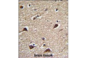 Formalin-fixed and paraffin-embedded human brain tissue reacted with PGLS Antibody , which was peroxidase-conjugated to the secondary antibody, followed by DAB staining. (PGLS anticorps  (C-Term))